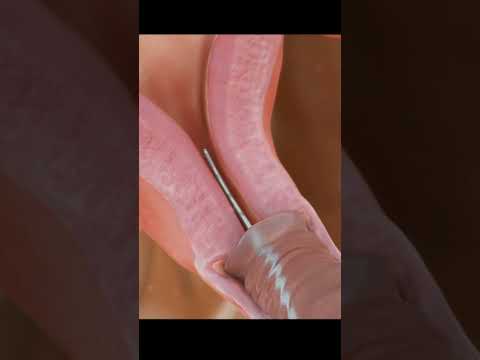 Image YouTube