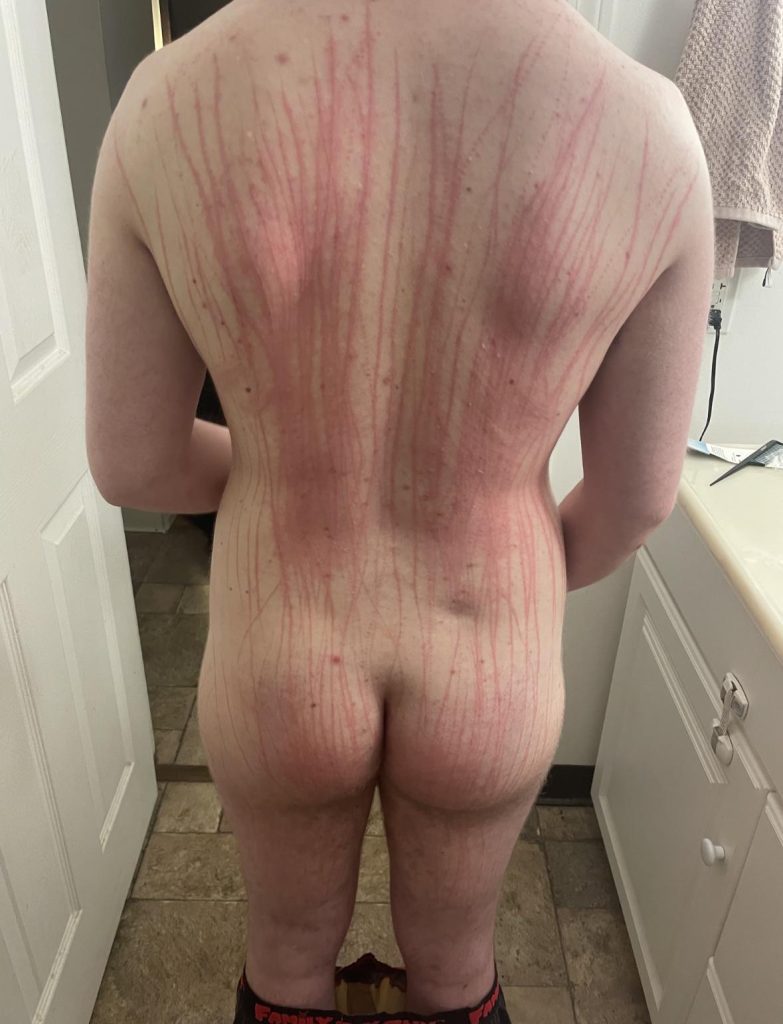 , *; Après que papa ait utilisé une roue Wartenberg sur moi
