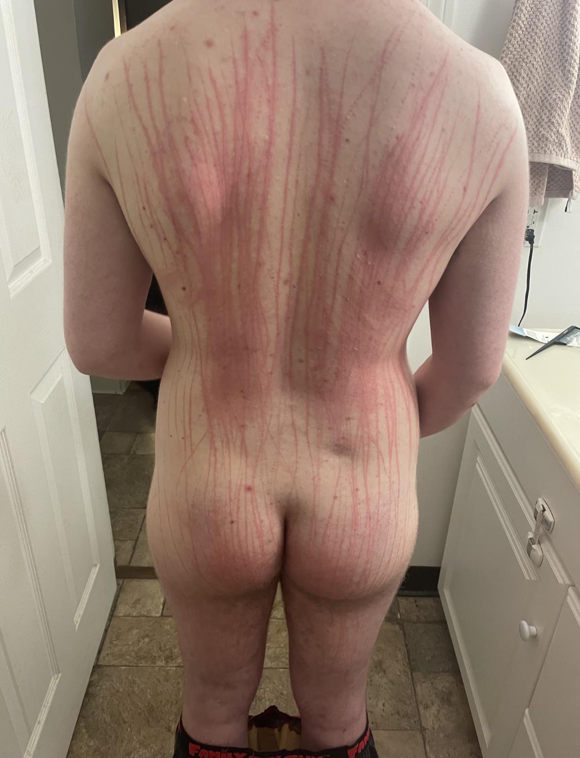 , *; Après que papa ait utilisé une roue Wartenberg sur moi