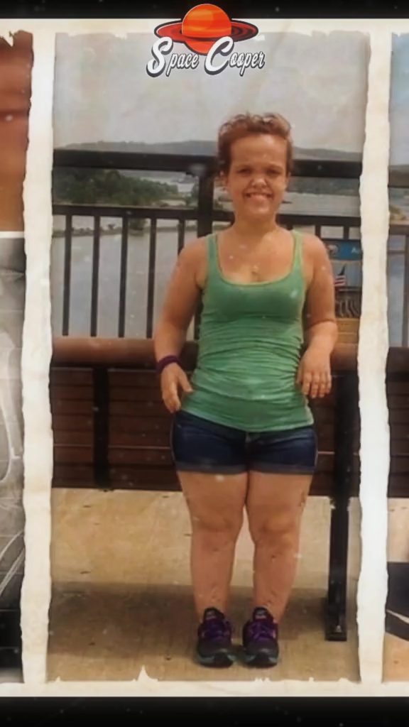 , onanismo; Un nain subit une opération chirurgicale pour grandir